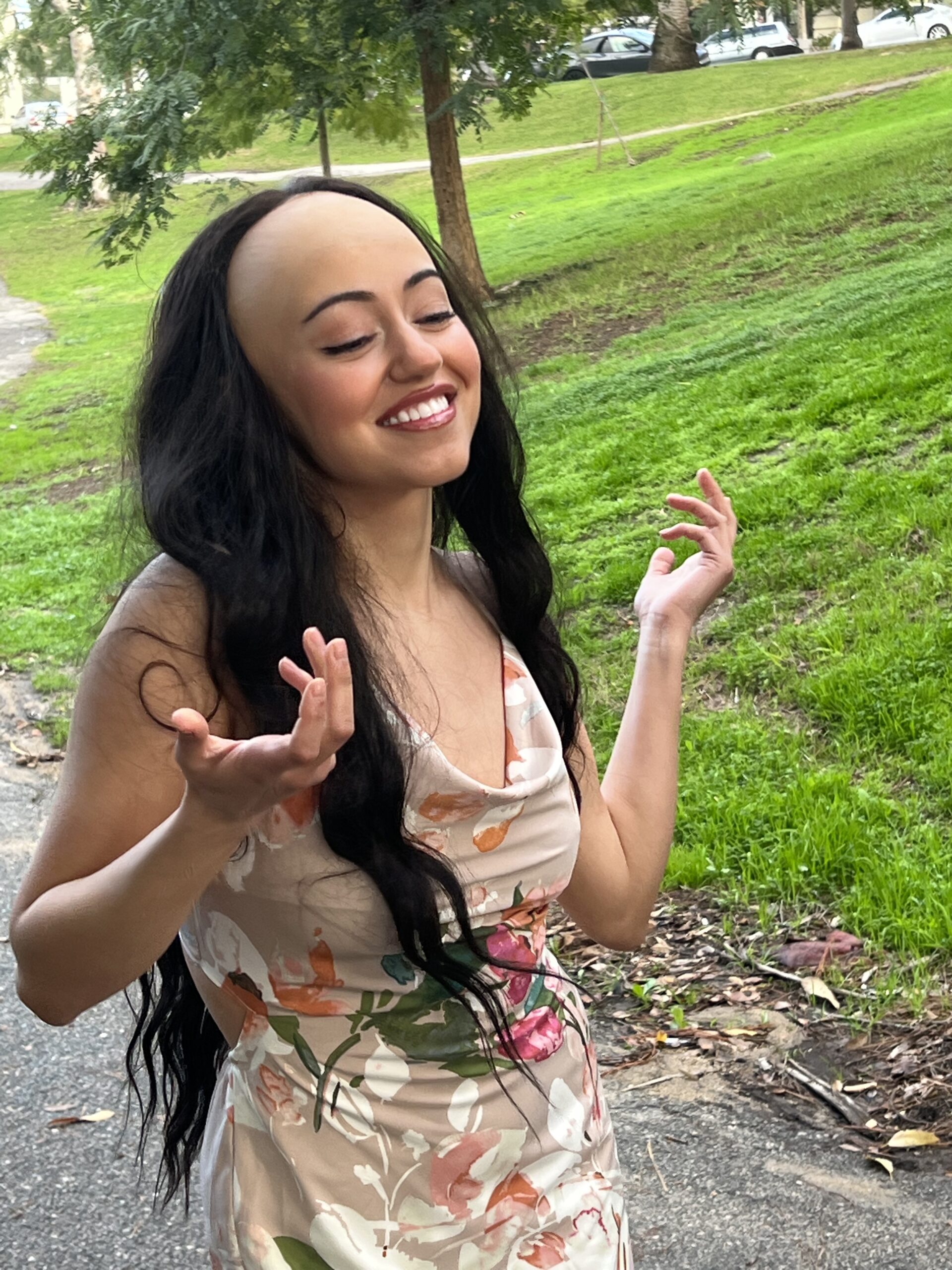 big forehead